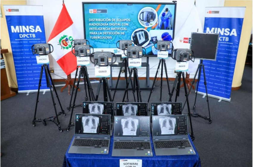  Perú usará inteligencia artificial para detectar tuberculosis